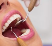 zobje v dentalni akademiji